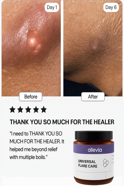 HS Flare Relief Cream